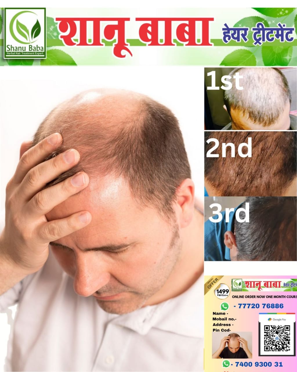 Shanu Baba Hair Treatment - Image 2