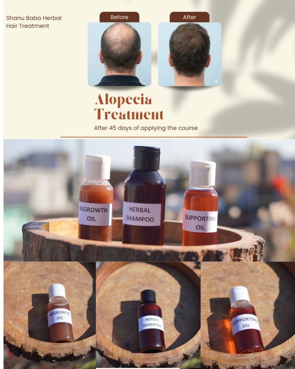 Shanu Baba Hair Treatment - Image 3