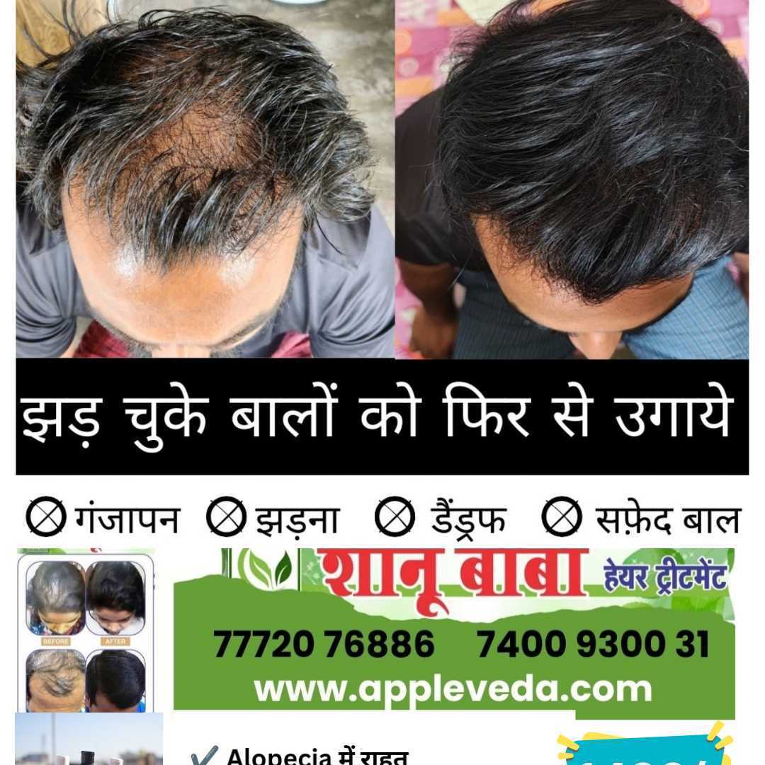 Shanu Baba Hair Treatment - Image 7