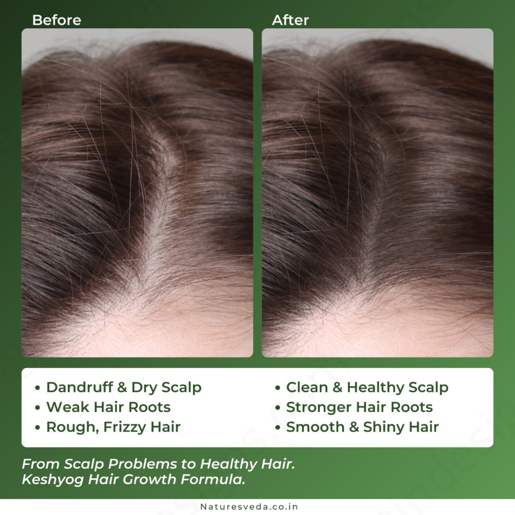 Keshyog Herbal Hair Treatment - Image 5